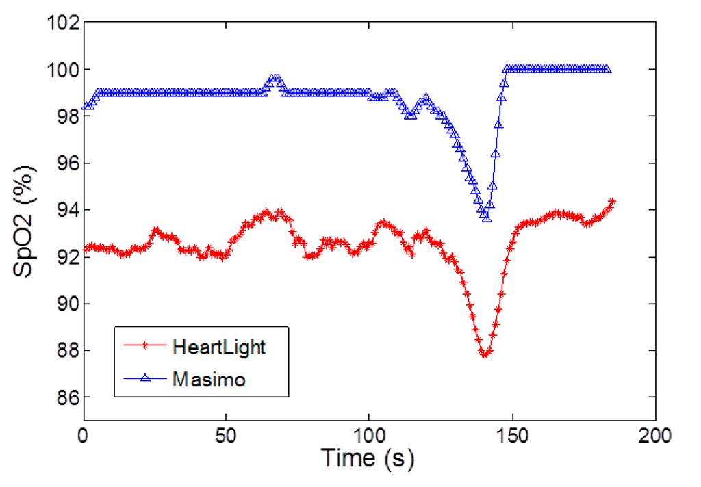 Sensors 15 17076 g008 1024