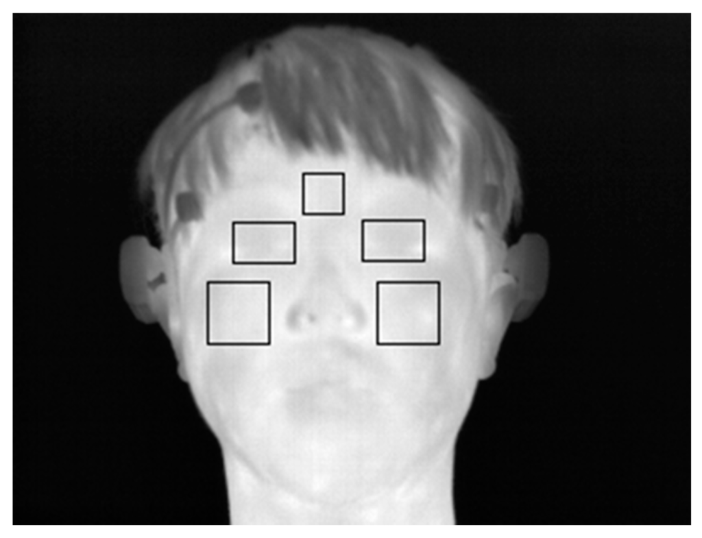Sensors 15 17507 g007 1024