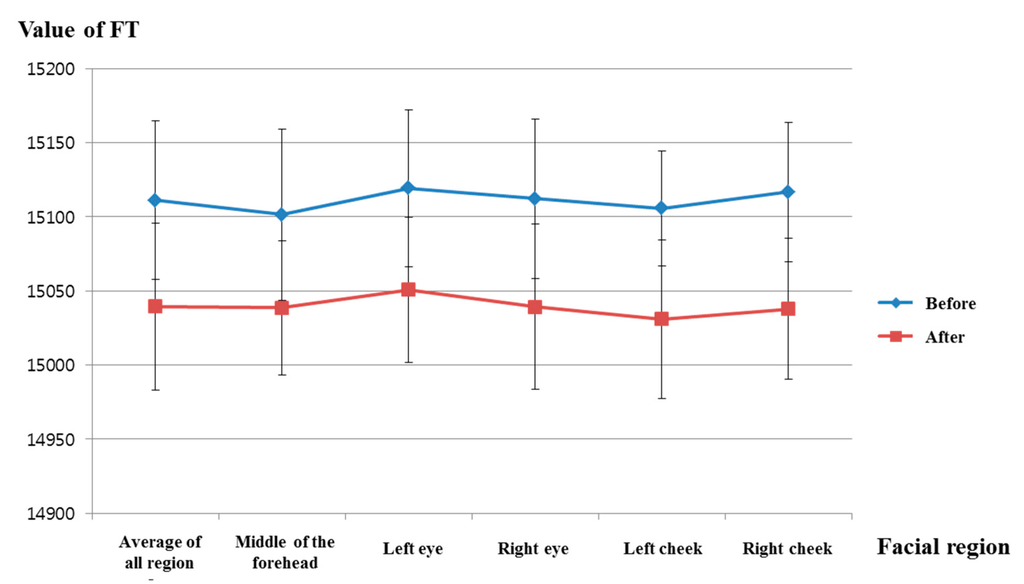 Sensors 15 17507 g014 1024
