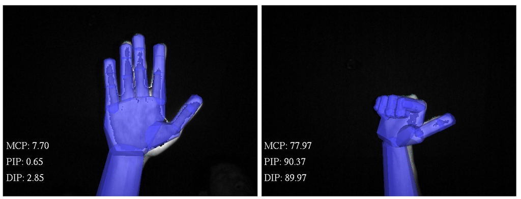 Sensors 15 18315 g008 1024