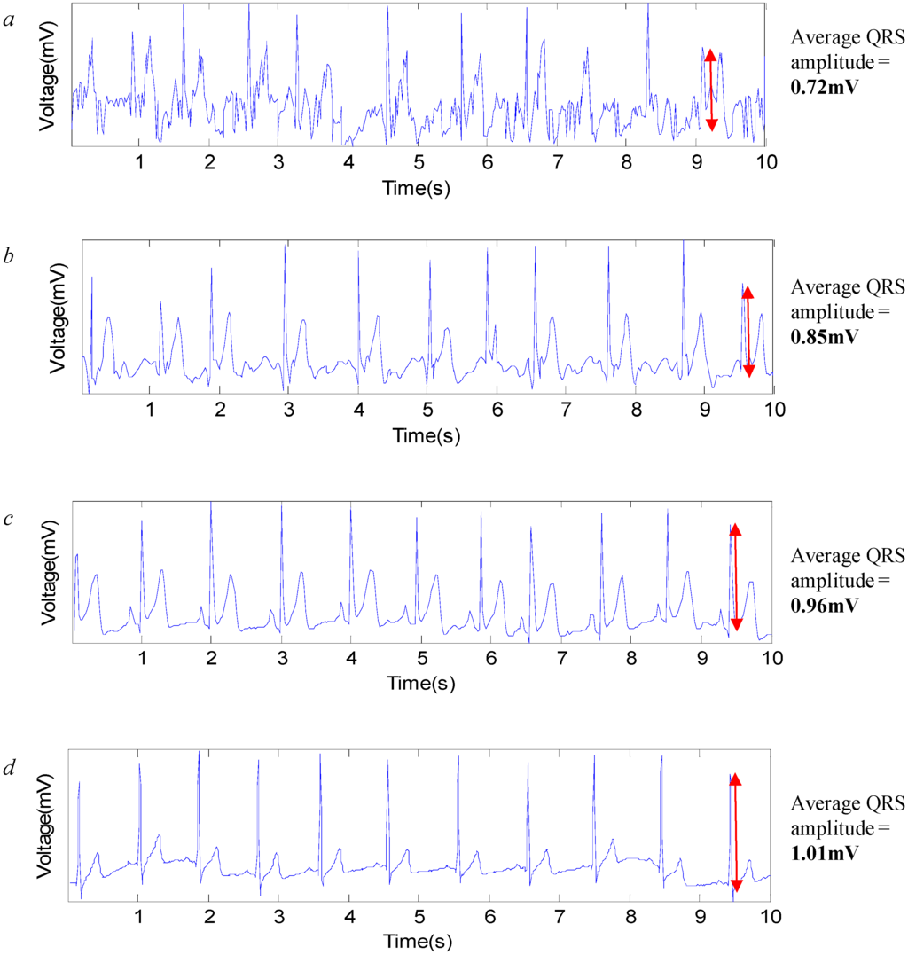Sensors 15 19237 g004 1024