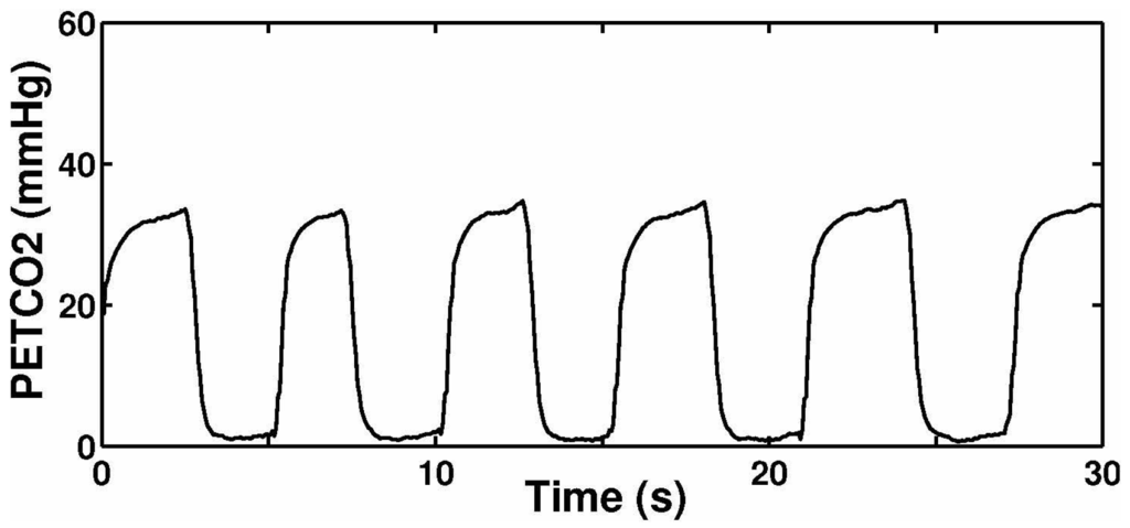 Sensors 15 19618 g015 1024