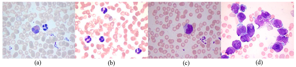 Sensors 15 22561 g005 1024