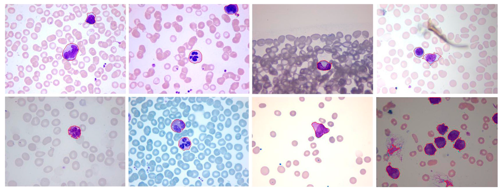 Sensors 15 22561 g013 1024