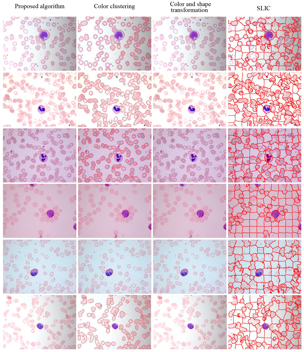 Sensors 15 22561 g015 1024