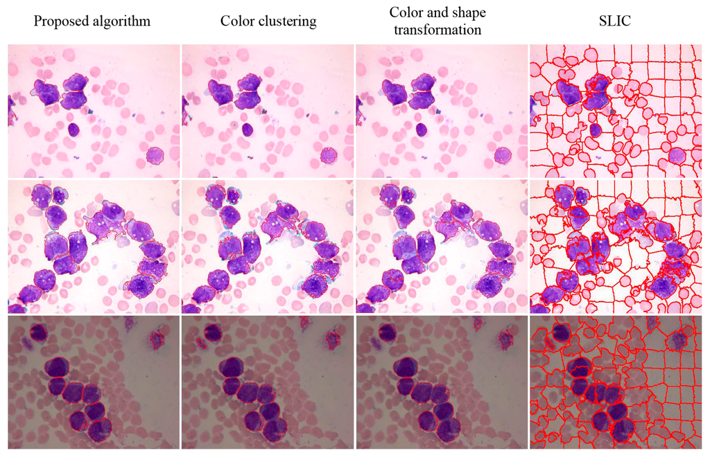 Sensors 15 22561 g016 1024