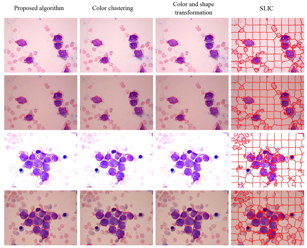 Sensors 15 22561 g017 1024