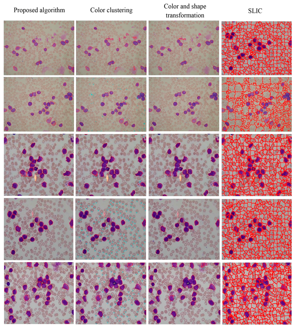 Sensors 15 22561 g018 1024