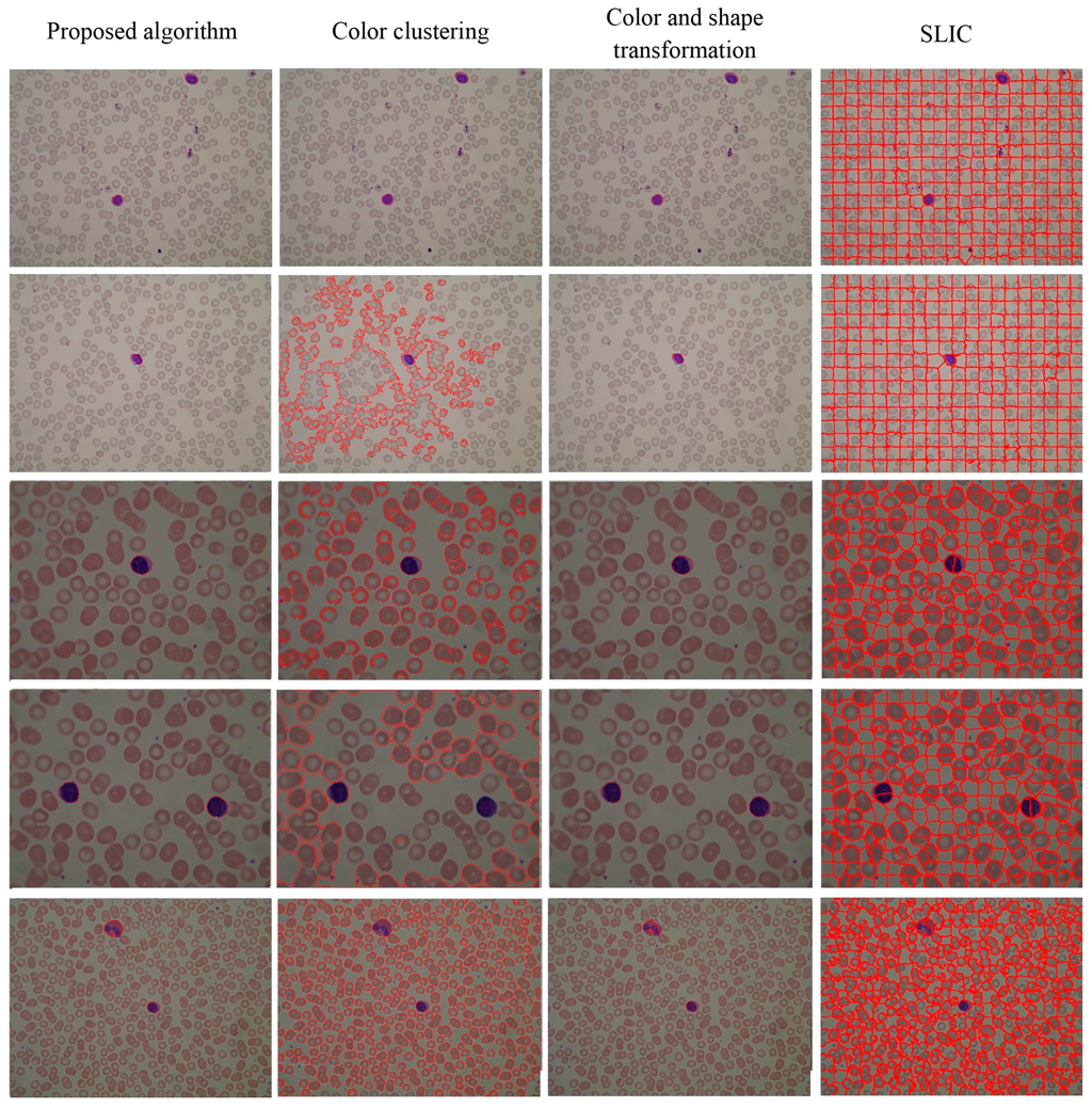 Sensors 15 22561 g019 1024
