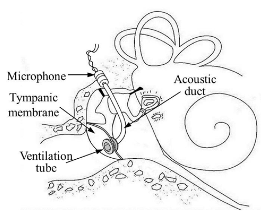 Sensors 15 22798 g002 1024