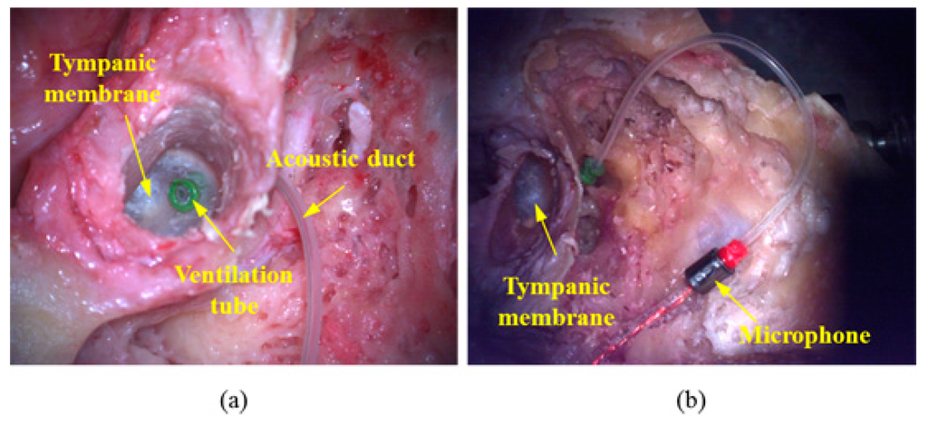 Sensors 15 22798 g004 1024