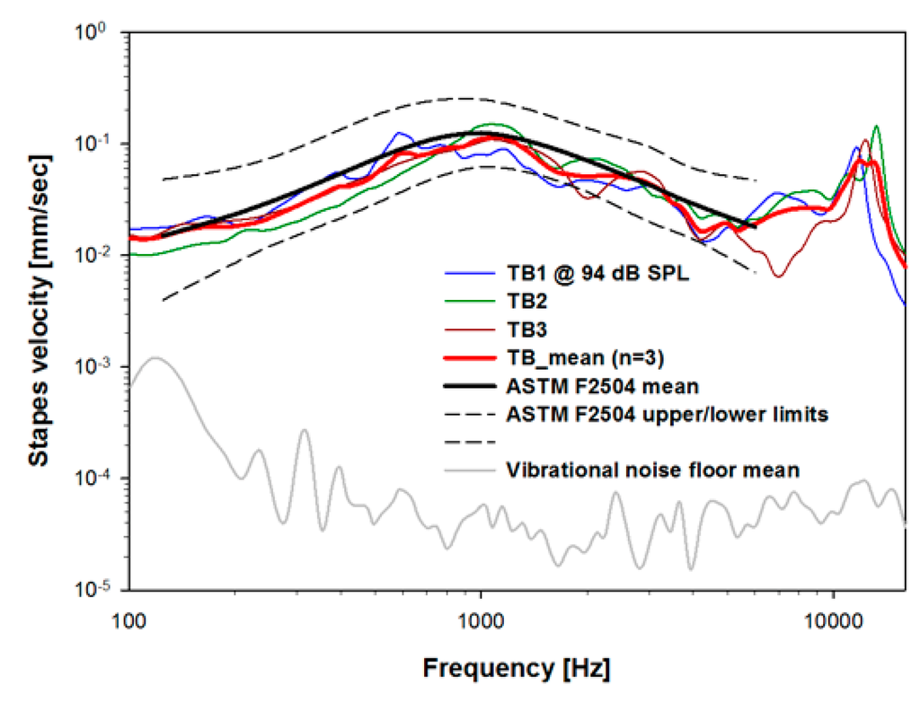 Sensors 15 22798 g005 1024