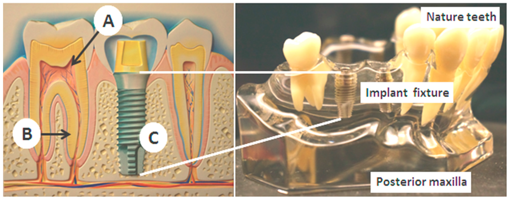 Sensors 15 24961 g001 1024