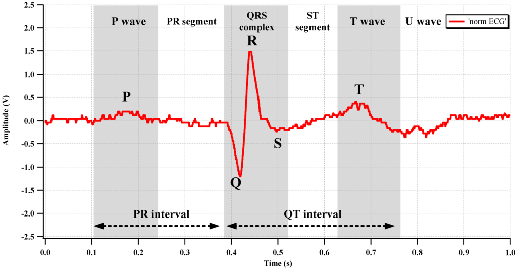 Sensors 15 25139 g019 1024