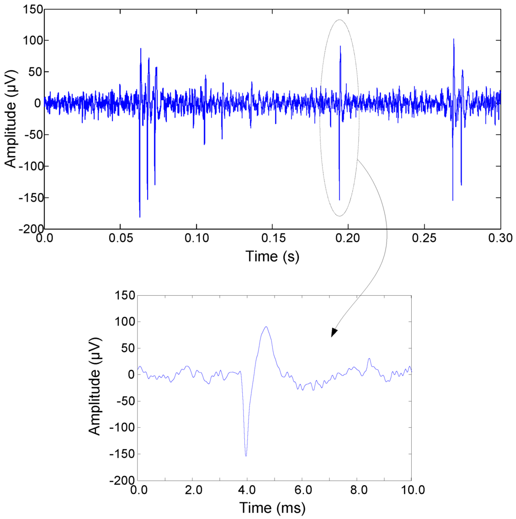Sensors 15 25313 g017 1024