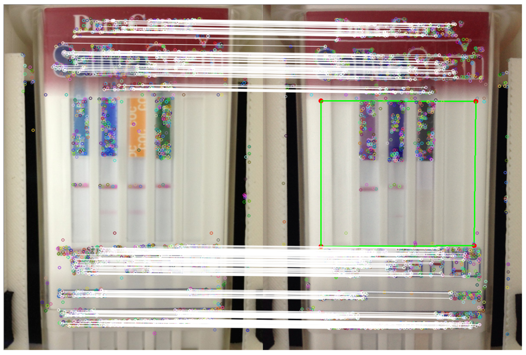 Sensors 15 29569 g005 1024