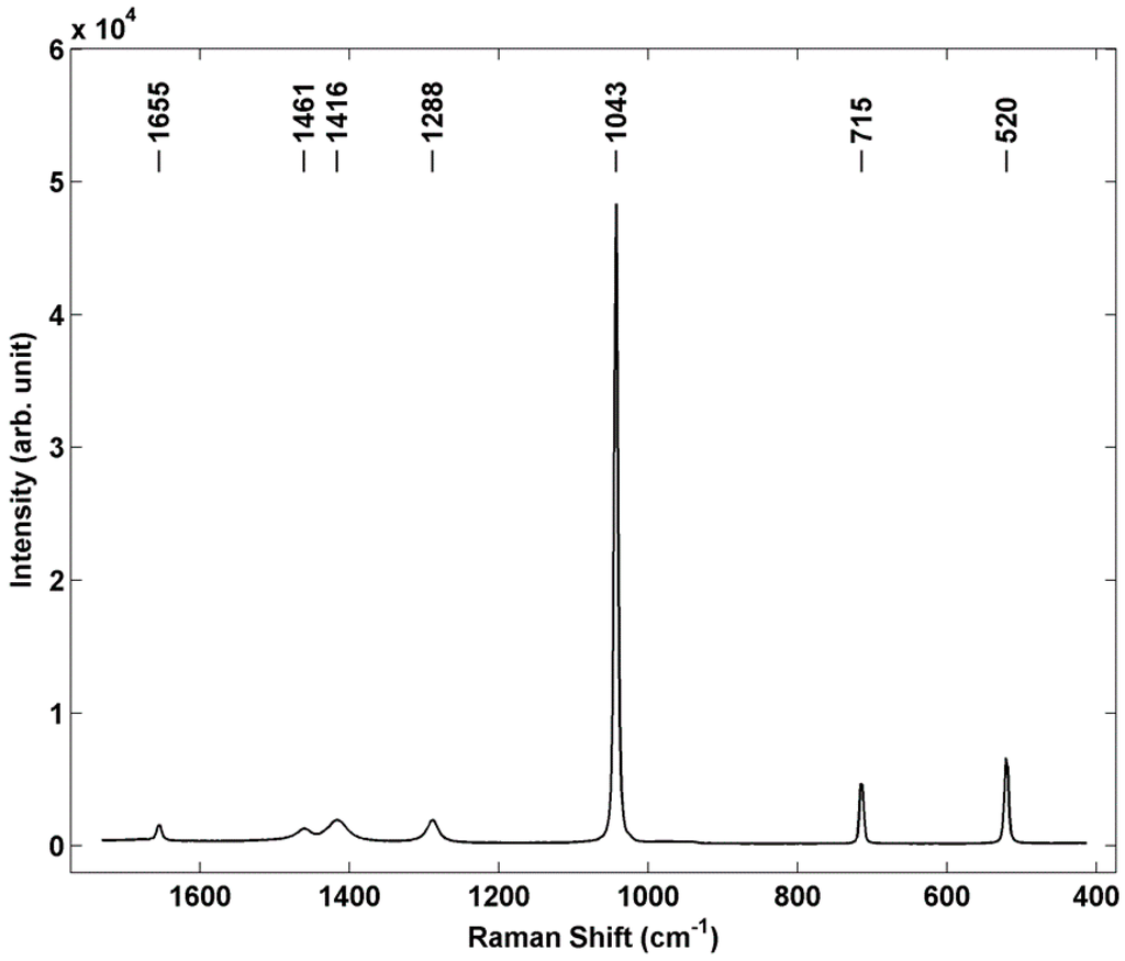 Sensors 15 29618 g006 1024