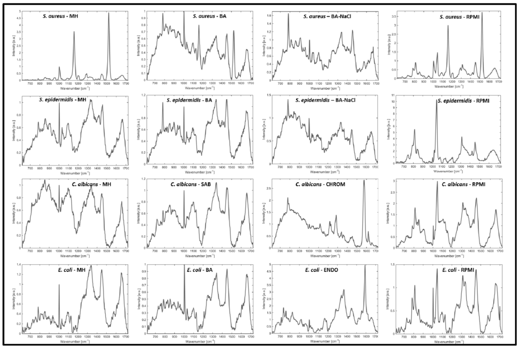 Sensors 15 29635 g004 1024