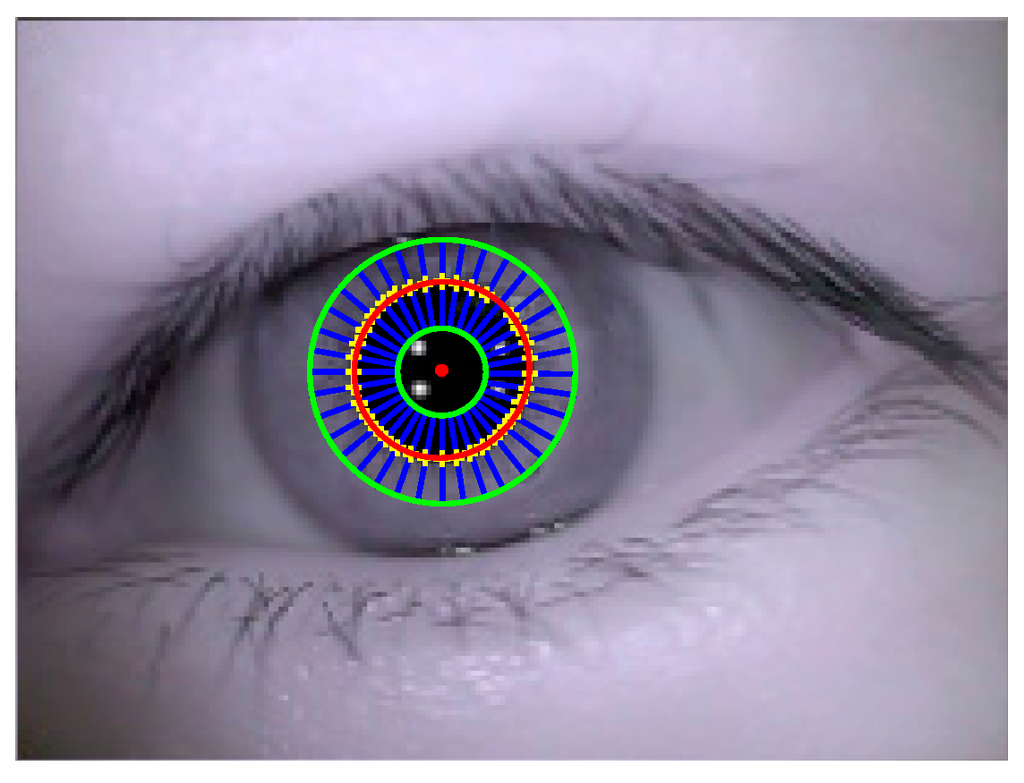 Sensors 15 29792 g007 1024