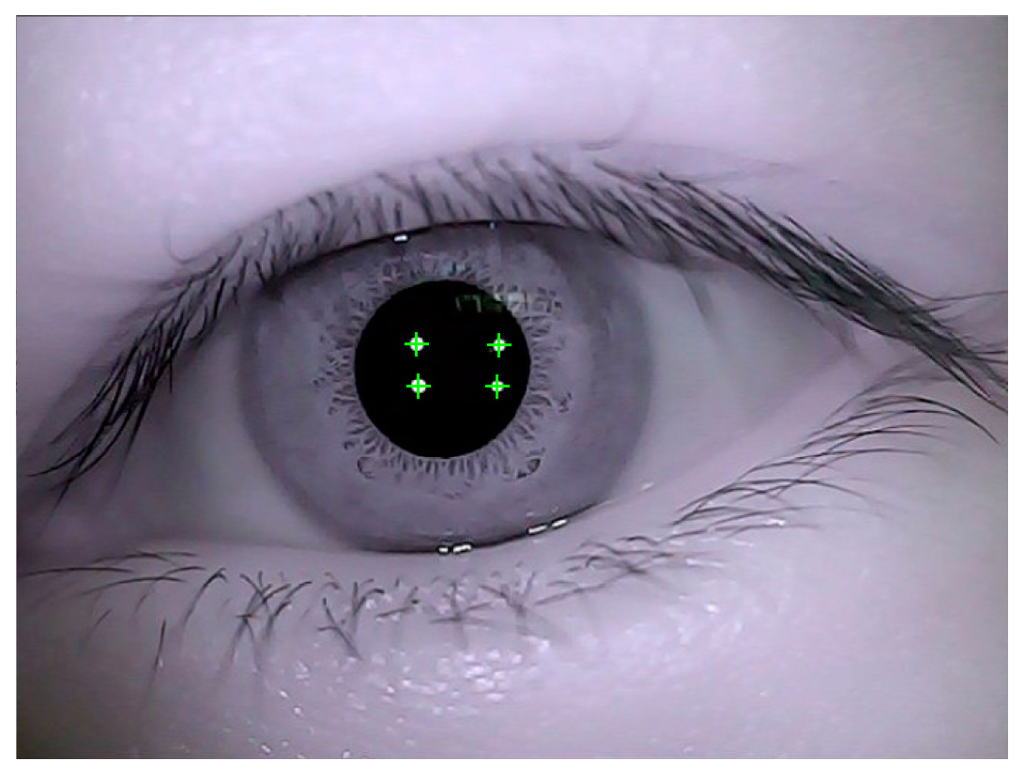 Sensors 15 29792 g010 1024