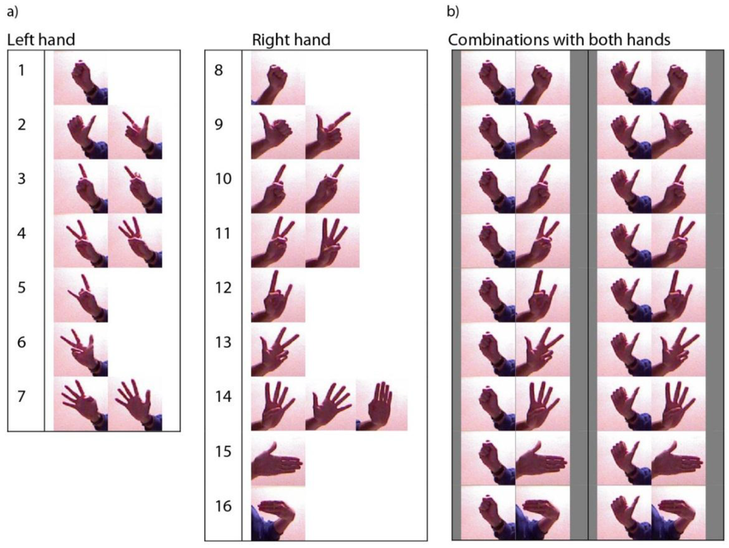 Sensors 15 29853 g020 1024