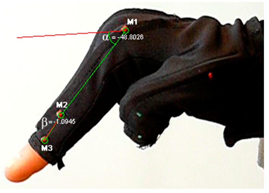 Sensors 15 29868 g010 1024