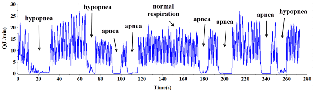 Sensors 15 29881 g013 1024