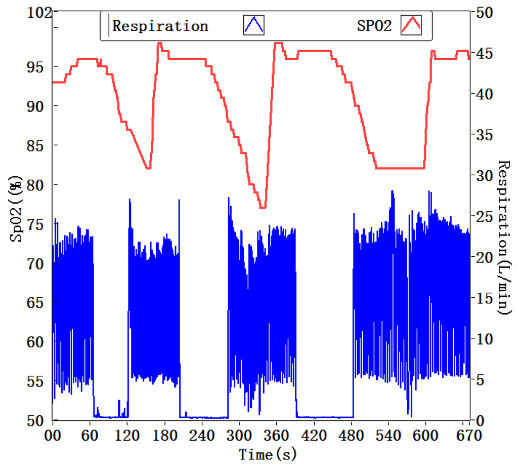 Sensors 15 29881 g014 1024