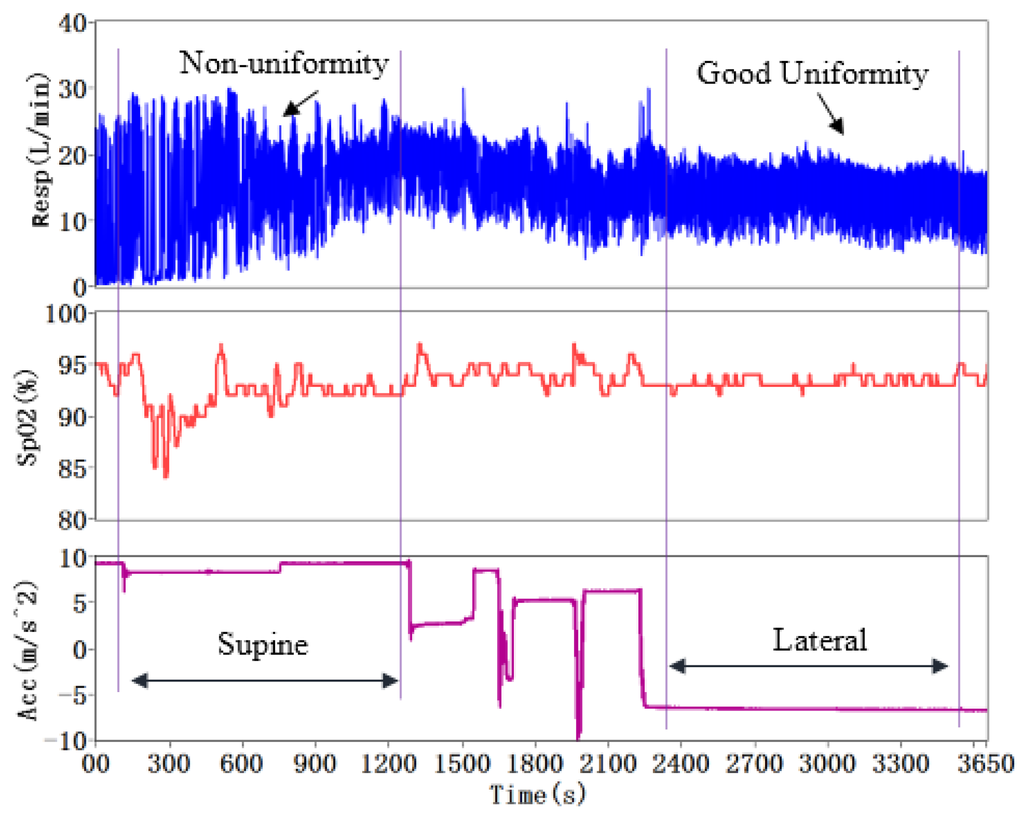 Sensors 15 29881 g015 1024
