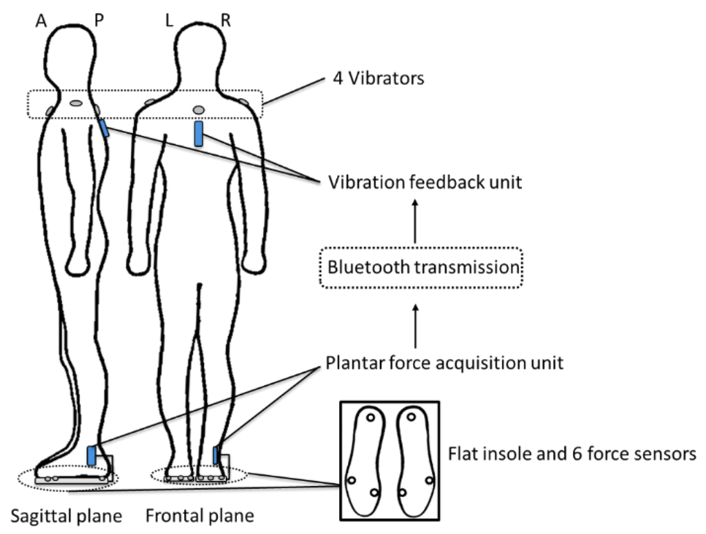 Sensors 15 29883 g001 1024