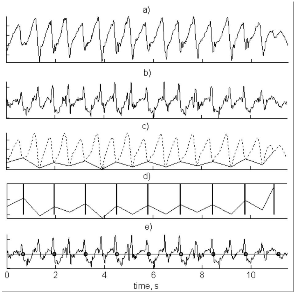 Sensors 16 00018 g017 1024