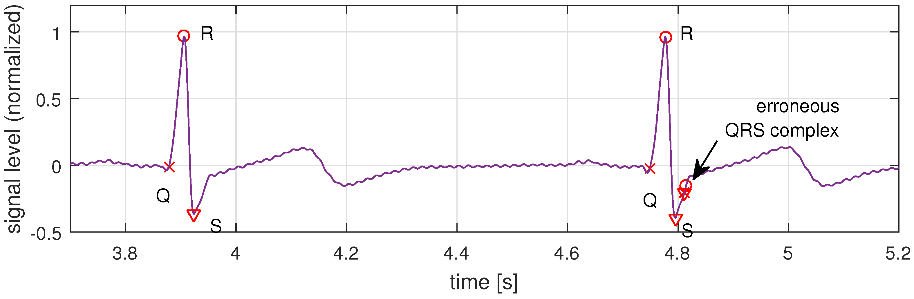 Sensors 16 00570 g007