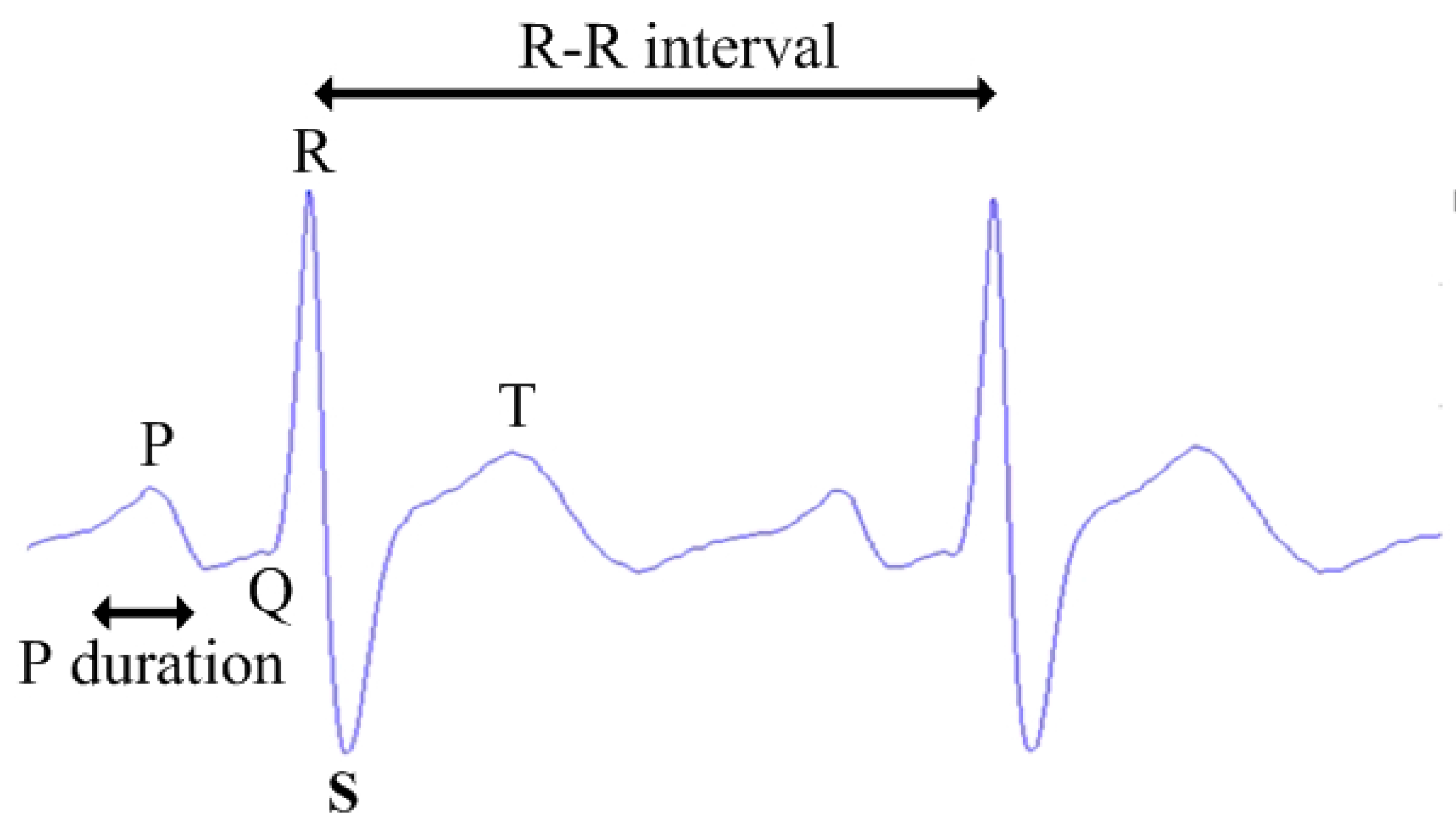 Sensors 16 00659 g003