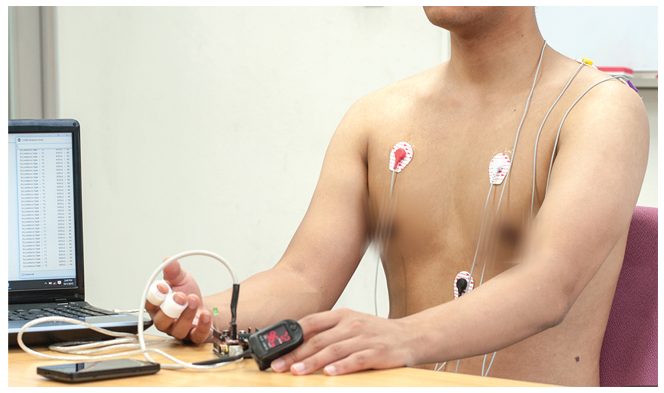 Sensors 16 01431 g002