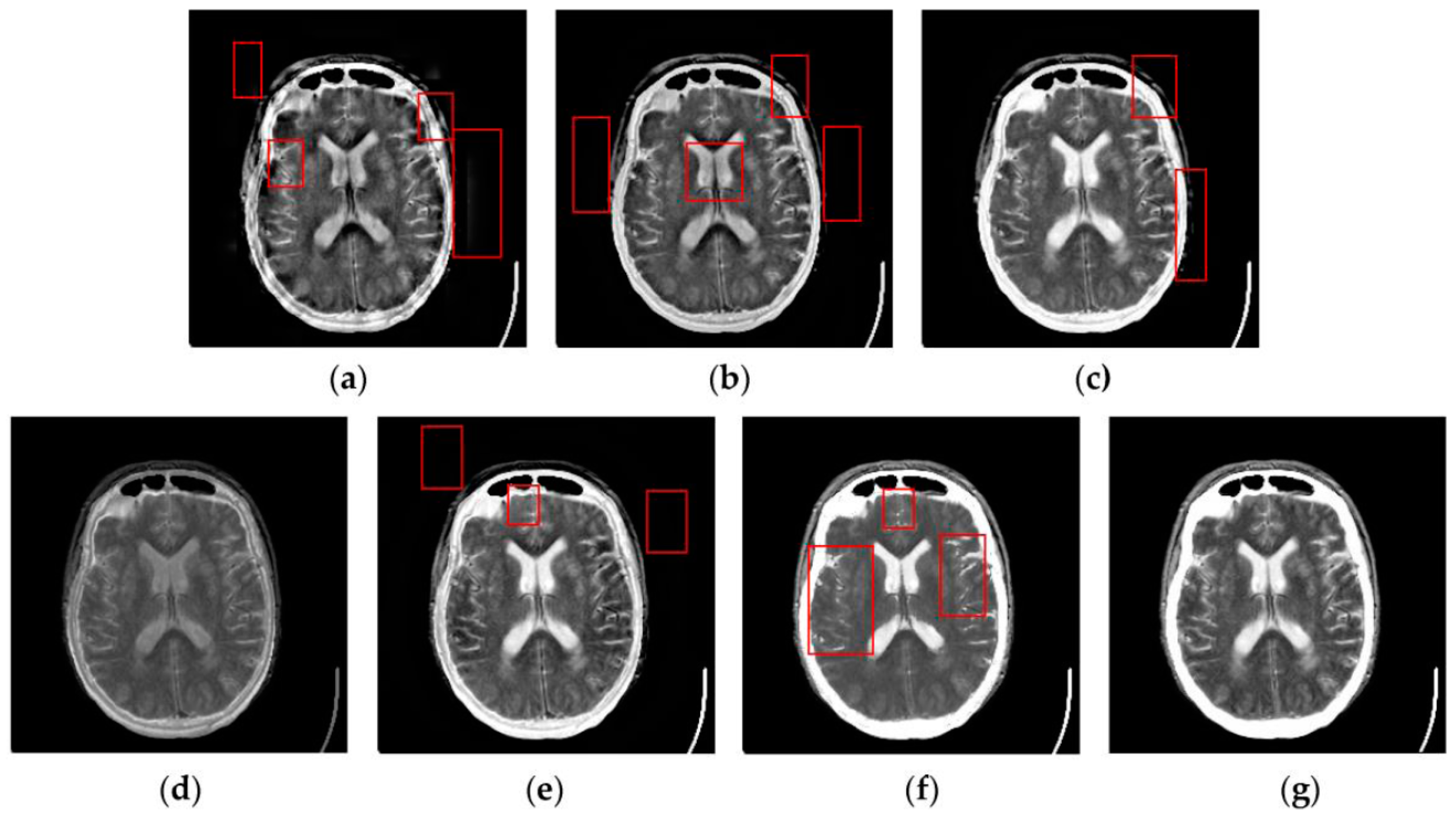 Sensors 16 01503 g007