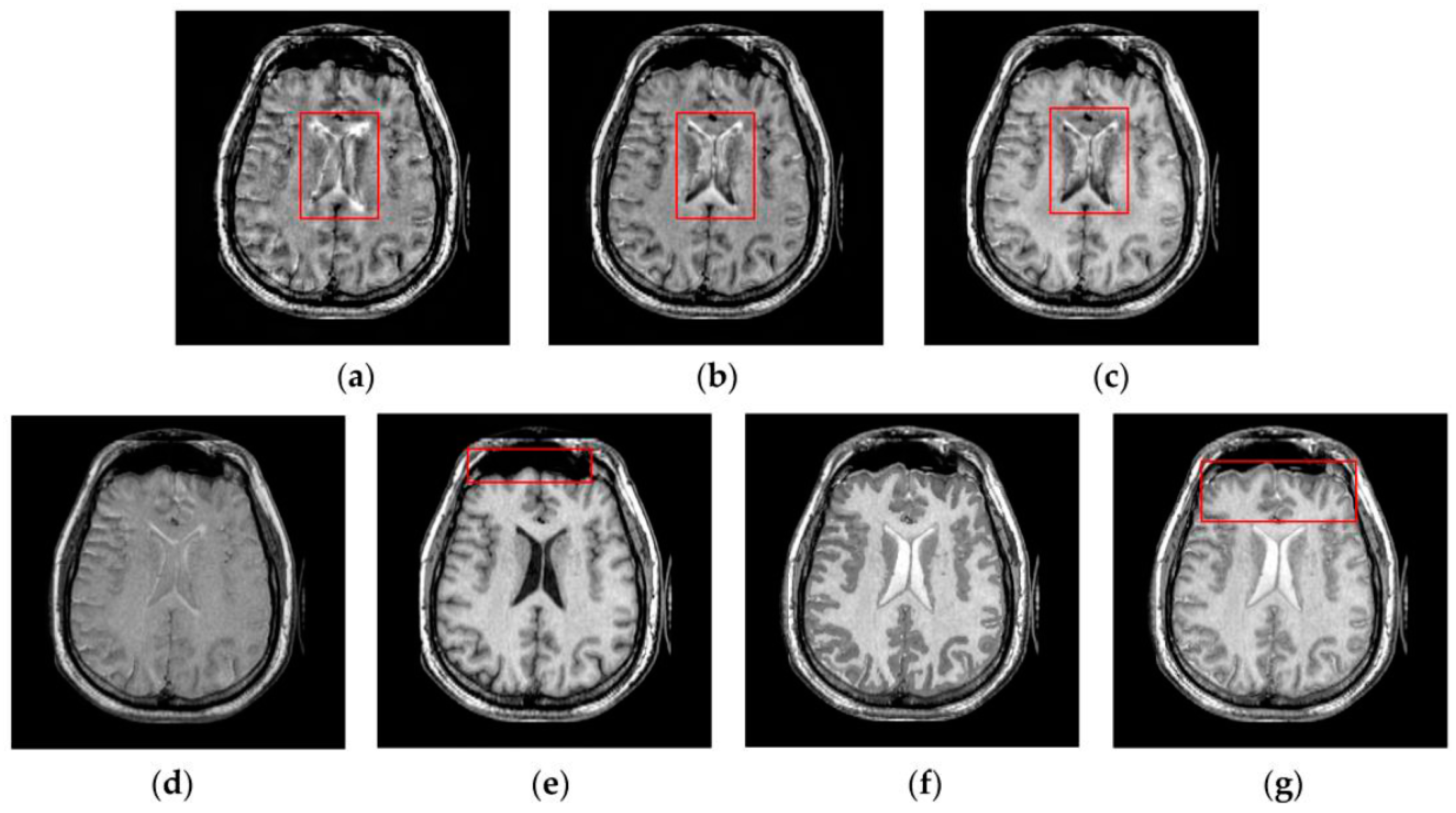 Sensors 16 01503 g009