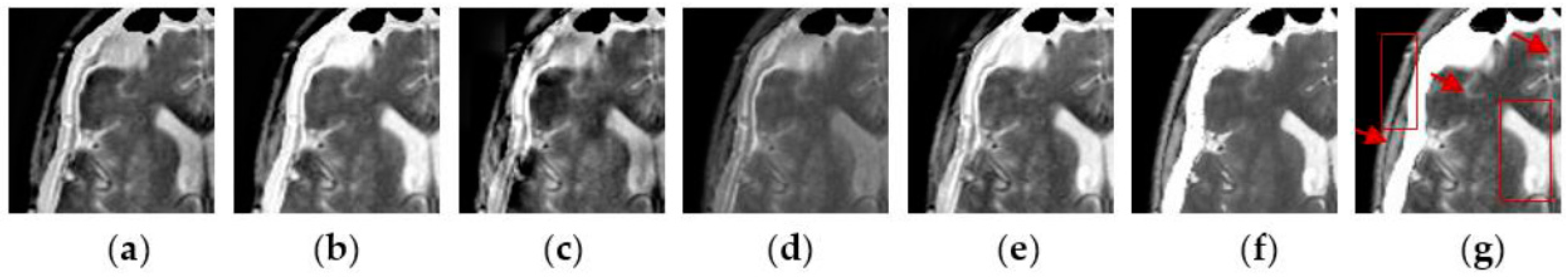 Sensors 16 01503 g011