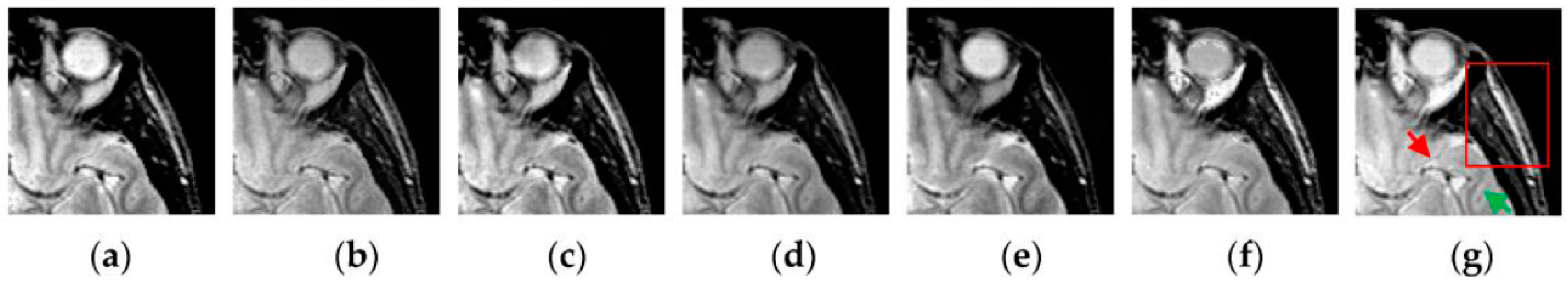 Sensors 16 01503 g012