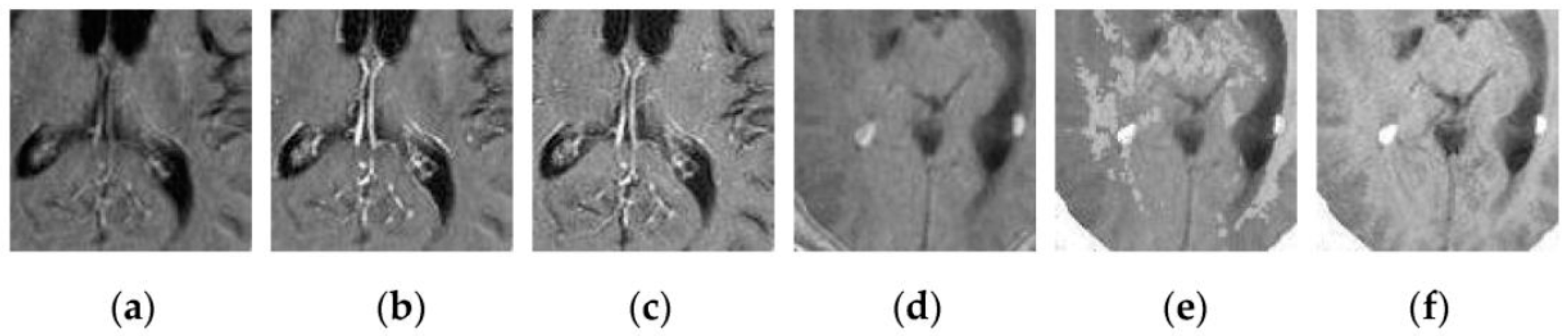 Sensors 16 01503 g013