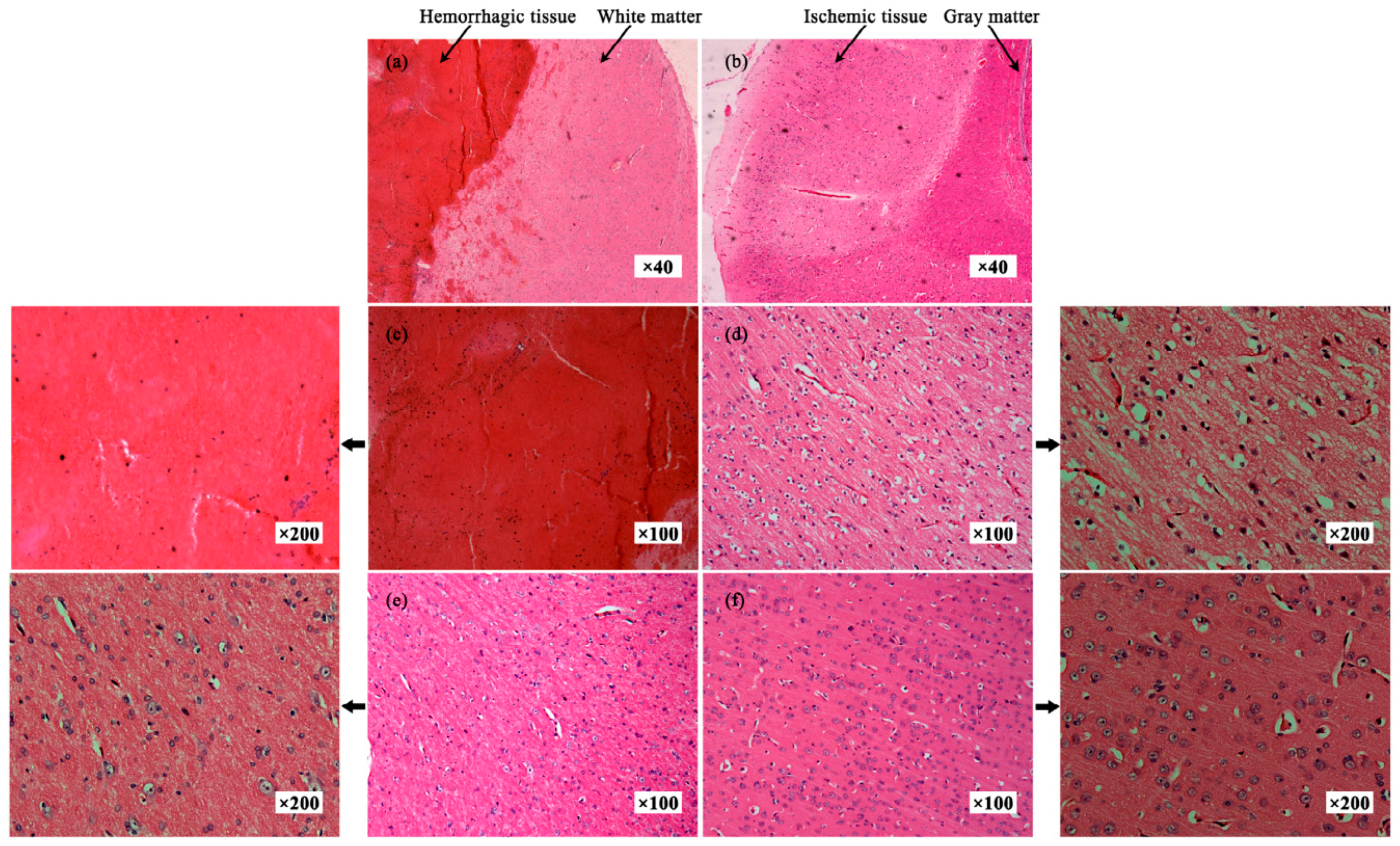 Sensors 16 01942 g009
