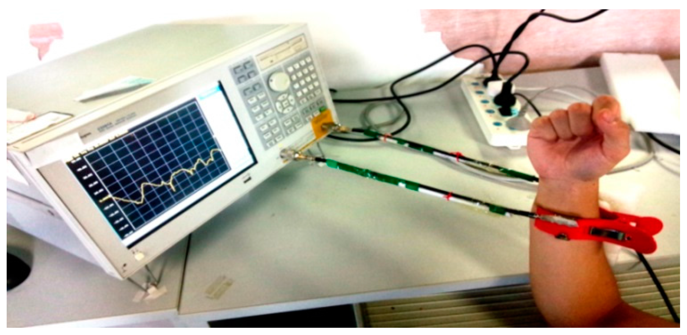 Sensors 17 00125 g004