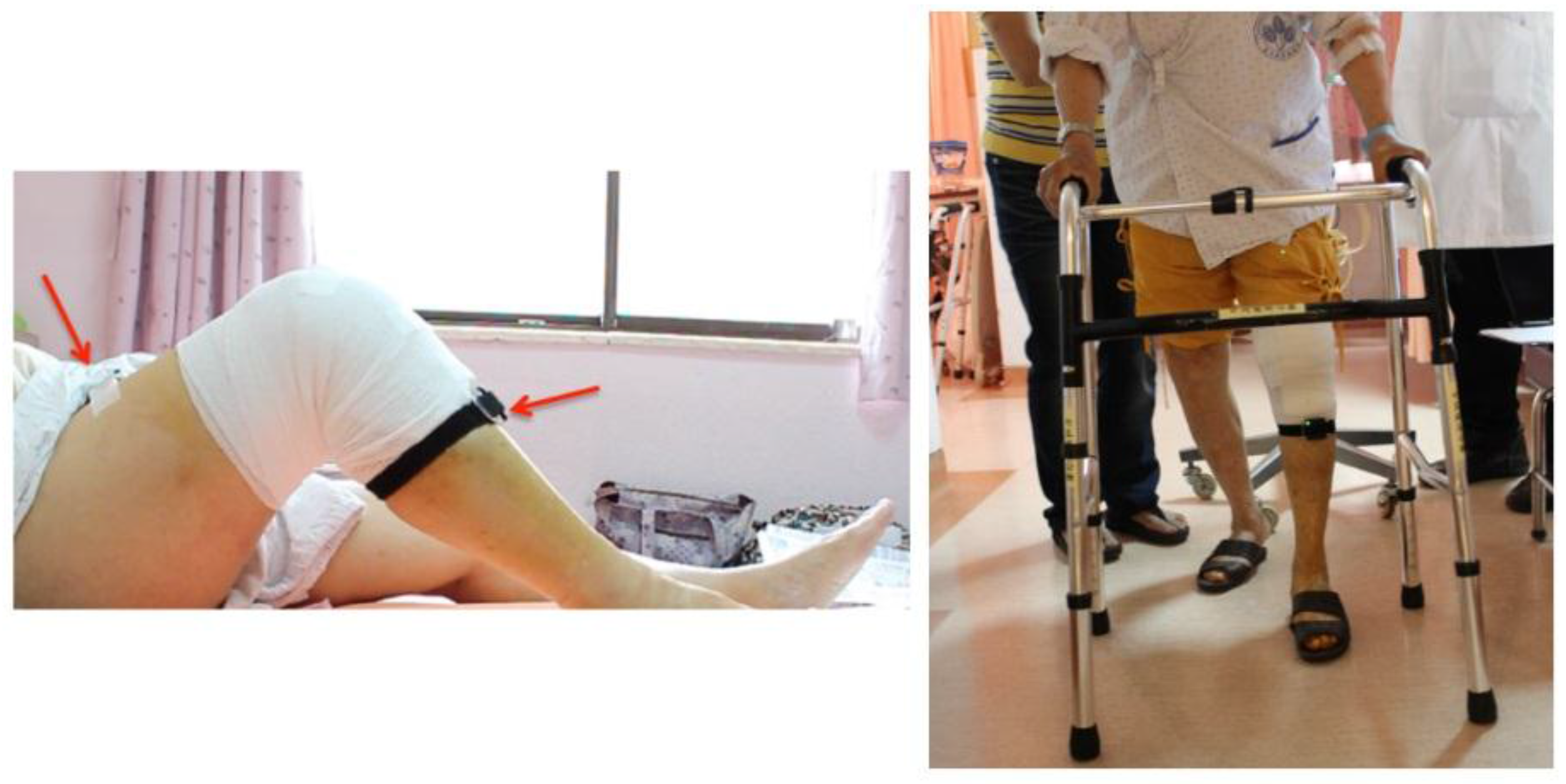 Sensors 17 00418 g005