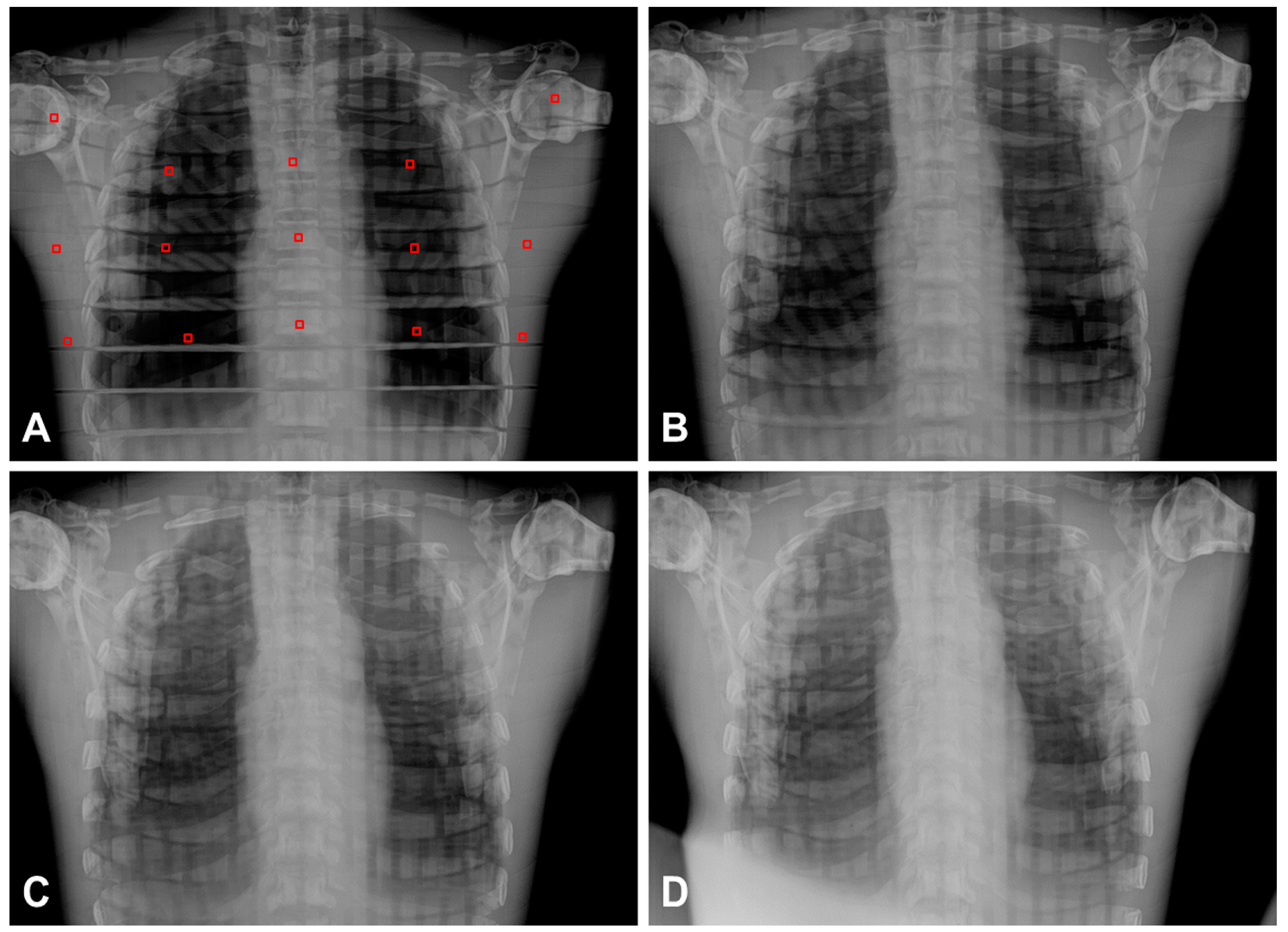 Sensors 17 00531 g006