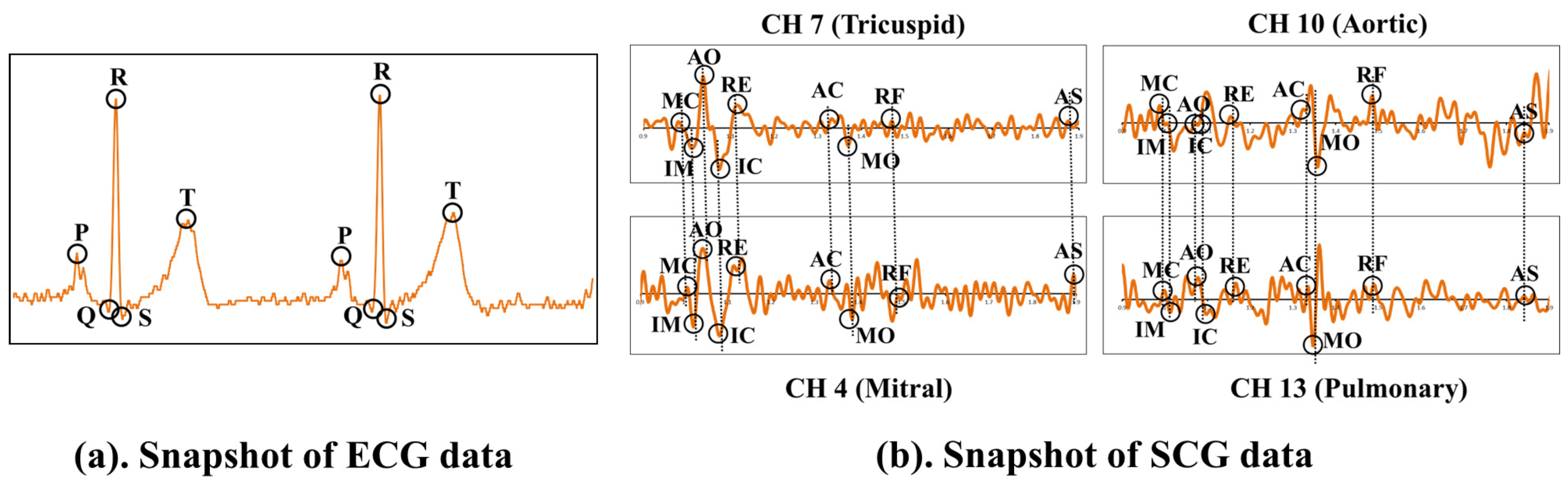 Sensors 17 00711 g014