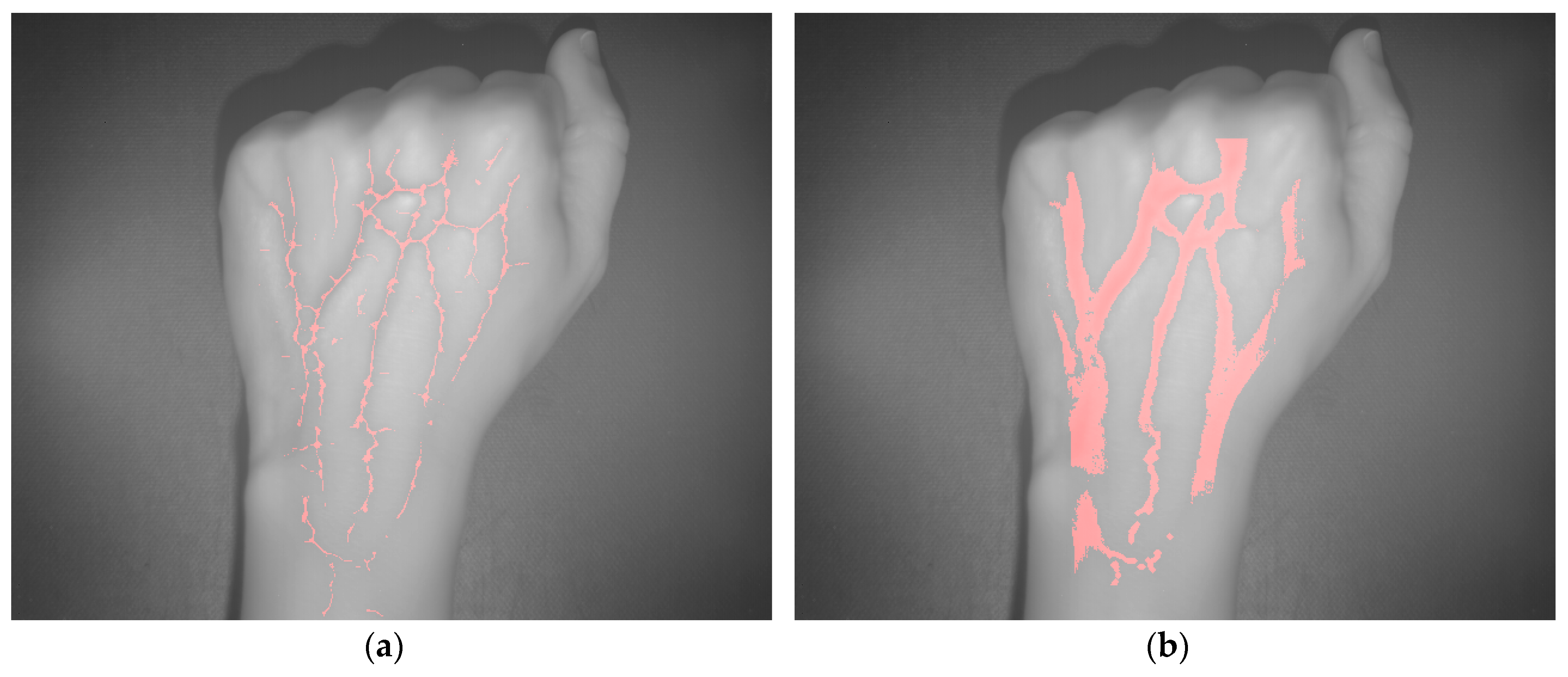 Sensors 17 00897 g005