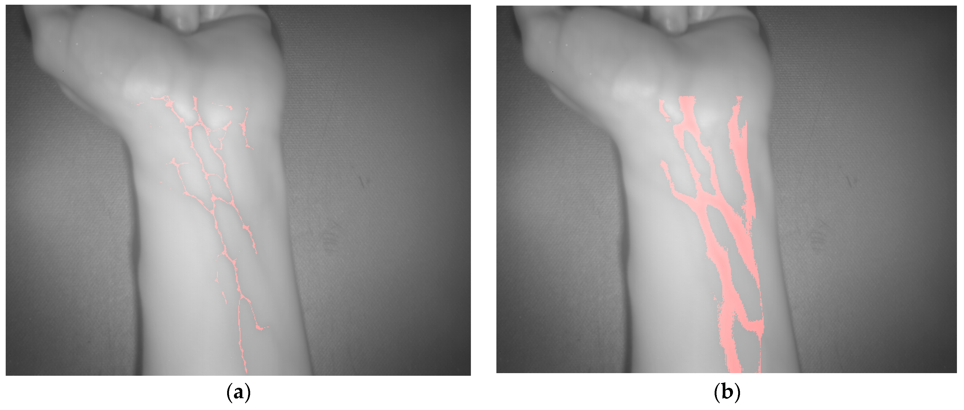 Sensors 17 00897 g009