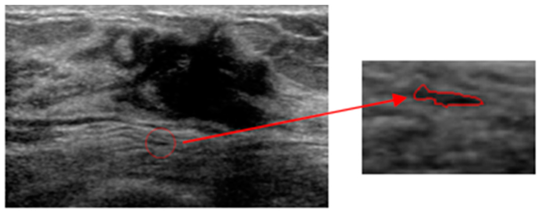 Sensors 17 01101 g004