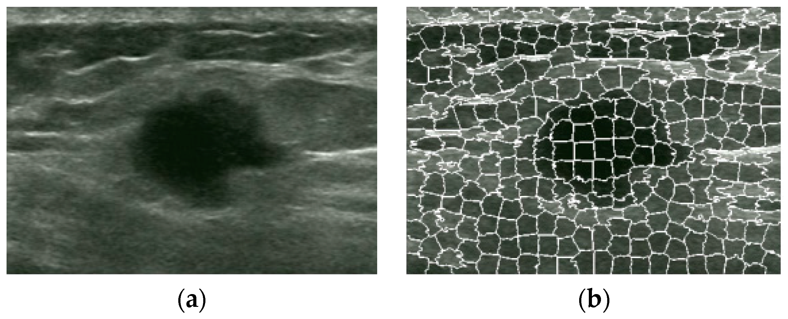 Sensors 17 01101 g006
