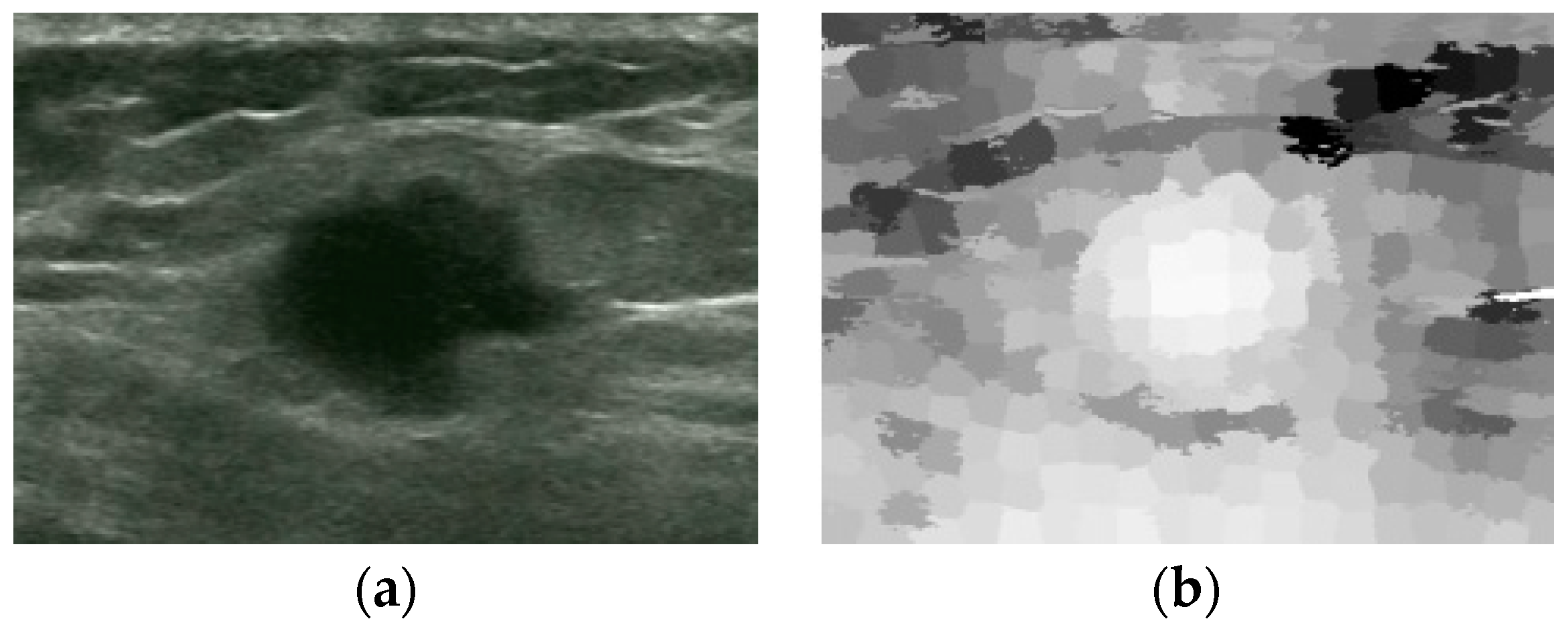 Sensors 17 01101 g007