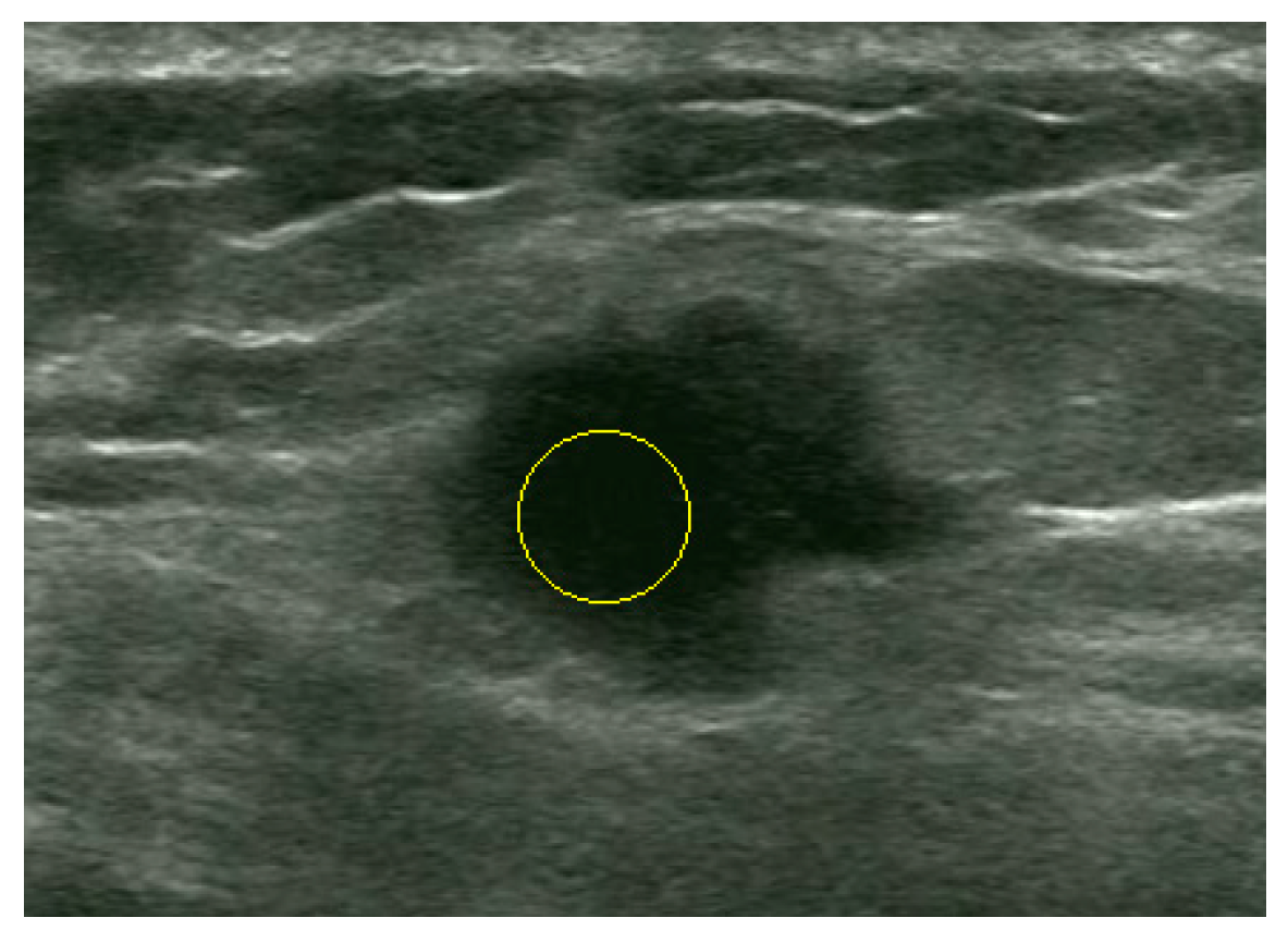 Sensors 17 01101 g009